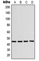 P2RX1 / P2X1 Antibody - Western blot analysis of P2X1 expression in K562 (A); A549 (B); SP2/0 (C); PC12 (D) whole cell lysates.