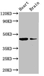P2RX1 / P2X1 Antibody - Western Blot Positive WB detected in: Mouse heart tissue, Mouse brain tissue All lanes: P2RX1 antibody at 3µg/ml Secondary Goat polyclonal to rabbit IgG at 1/50000 dilution Predicted band size: 45 kDa Observed band size: 45 kDa
