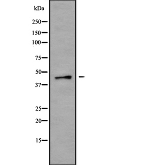 P2RX1 / P2X1 Antibody - Western blot analysis of P2RX1 using K562 whole cells lysates
