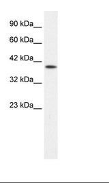 P2RX2 / P2X2 Antibody - Jurkat Cell Lysate.  This image was taken for the unconjugated form of this product. Other forms have not been tested.