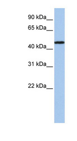 P2RX2 / P2X2 Antibody - P2RX2 / P2X2 antibody Western blot of Jurkat lysate. This image was taken for the unconjugated form of this product. Other forms have not been tested.