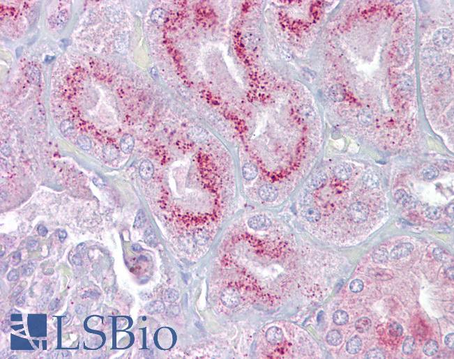 P2RX2 / P2X2 Antibody - Anti-P2RX2 / P2X2 antibody IHC of human kidney. Immunohistochemistry of formalin-fixed, paraffin-embedded tissue after heat-induced antigen retrieval. Antibody concentration 5 ug/ml.  This image was taken for the unconjugated form of this product. Other forms have not been tested.