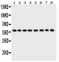 P2RX2 / P2X2 Antibody - P2X2 antibody Western blot. All lanes: Anti P2X2 at 0.5 ug/ml. Lane 1: Rat Brain Tissue Lysate at 50 ug. Lane 2: Mouse Brain Tissue Lysate at 50 ug. Lane 3: Human Placenta Tissue Lysate at 50 ug. Lane 4: HELA Whole Cell Lysate at 40 ug. Lane 5: SHG Whole Cell Lysate at 40 ug. Lane 6: NEURO Whole Cell Lysate at 40 ug. Lane 7: 22RV1 Whole Cell Lysate at 40 ug. Lane 8: U87 Whole Cell Lysate at 40 ug. Predicted band size: 52 kD. Observed band size: 60 kD.