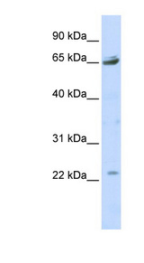 P2RX2 / P2X2 Antibody - P2RX2 / P2X2 antibody Western blot of 293T cell lysate. This image was taken for the unconjugated form of this product. Other forms have not been tested.