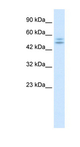 P2RX2 / P2X2 Antibody - P2RX2 / P2X2 antibody Western blot of Jurkat lysate. This image was taken for the unconjugated form of this product. Other forms have not been tested.