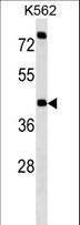 P2RX2 / P2X2 Antibody - P2RX2 Antibody western blot of K562 cell line lysates (35 ug/lane). The P2RX2 antibody detected the P2RX2 protein (arrow).