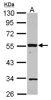 P2RX2 / P2X2 Antibody - Sample (30 ug of whole cell lysate) A: HepG2 10% SDS PAGE P2RX2 / P2X2 antibody diluted at 1:1000