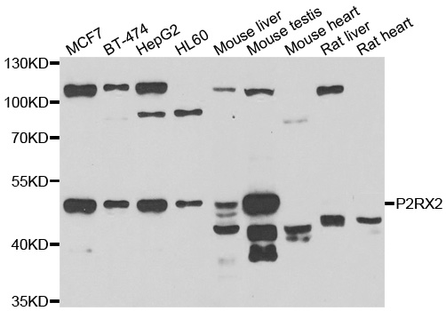 P2RX2 / P2X2 Antibody - Western blot analysis of extracts of various cell lines.