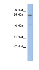 P2RX2 / P2X2 Antibody - P2RX2 / P2X2 antibody Western blot of OVCAR-3 cell lysate. This image was taken for the unconjugated form of this product. Other forms have not been tested.