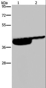 P2RX3 / P2X3 Antibody - Western blot analysis of Human bladder and bladder transitional cell carcinoma tissue, using P2RX3 Polyclonal Antibody at dilution of 1:250.