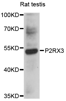 P2RX3 / P2X3 Antibody - Western blot analysis of extracts of rat testis, using P2RX3 antibody at 1:1000 dilution. The secondary antibody used was an HRP Goat Anti-Rabbit IgG (H+L) at 1:10000 dilution. Lysates were loaded 25ug per lane and 3% nonfat dry milk in TBST was used for blocking. An ECL Kit was used for detection and the exposure time was 20s.