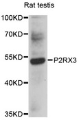 P2RX3 / P2X3 Antibody - Western blot analysis of extracts of rat testis, using P2RX3 antibody at 1:1000 dilution. The secondary antibody used was an HRP Goat Anti-Rabbit IgG (H+L) at 1:10000 dilution. Lysates were loaded 25ug per lane and 3% nonfat dry milk in TBST was used for blocking. An ECL Kit was used for detection and the exposure time was 20s.