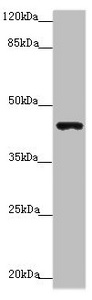 P2RX3 / P2X3 Antibody - Western blot All Lanes: P2RX3 antibody at 3.91 ug/ml+ Mouse liver tissue Secondary Goat polyclonal to rabbit IgG at 1/10000 dilution Predicted band size: 44 kDa Observed band size: 44 kDa