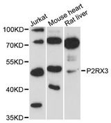 P2RX3 / P2X3 Antibody - Western blot analysis of extracts of various cell lines, using P2RX3 antibody at 1:3000 dilution. The secondary antibody used was an HRP Goat Anti-Rabbit IgG (H+L) at 1:10000 dilution. Lysates were loaded 25ug per lane and 3% nonfat dry milk in TBST was used for blocking. An ECL Kit was used for detection and the exposure time was 90s.