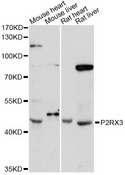 P2RX3 / P2X3 Antibody - Western blot analysis of extracts of various cell lines, using P2RX3 antibody at 1:3000 dilution. The secondary antibody used was an HRP Goat Anti-Rabbit IgG (H+L) at 1:10000 dilution. Lysates were loaded 25ug per lane and 3% nonfat dry milk in TBST was used for blocking. An ECL Kit was used for detection and the exposure time was 90s.