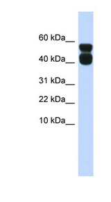 P2RX4 / P2X4 Antibody - P2RX4 / P2X4 antibody Western blot of Fetal Muscle lysate. This image was taken for the unconjugated form of this product. Other forms have not been tested.