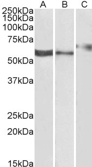 P2RX4 / P2X4 Antibody - Goat Anti-P2X4 / P2X4R Antibody (1µg/ml) staining of Human Kidney (A), Human Liver (B) and Rat Kidney (C) lysate (35µg protein in RIPA buffer). Detected by chemiluminescencence.