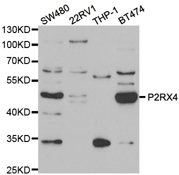 P2RX4 / P2X4 Antibody - Western blot analysis of extracts of various cell lines.