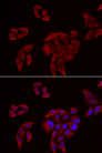 P2RX4 / P2X4 Antibody - Immunofluorescence analysis of U2OS cells.