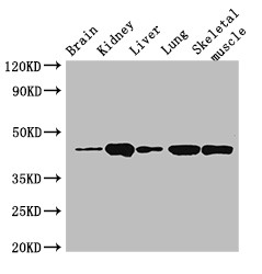 P2RX4 / P2X4 Antibody - Positive WB detected in:Mouse brain tissue,Mouse kidney tissue,Mouse liver tissue,Rat lung tissue,Rat skeletal muscle tissue;All lanes:P2RX4 antibody at 3?g/ml;Secondary;Goat polyclonal to rabbit IgG at 1/50000 dilution;Predicted band size: 44,46,41 KDa;Observed band size: 44 KDa;