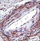 P2RX5 / P2X5 Antibody - P2RX5 Antibody immunohistochemistry of formalin-fixed and paraffin-embedded human cervix tissue followed by peroxidase-conjugated secondary antibody and DAB staining.
