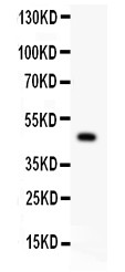 P2RX5 / P2X5 Antibody - P2X5 antibody Western blot. All lanes: Anti P2X5 at 0.5 ug/ml. WB: Rat Brain Tissue Lysate at 50 ug. Predicted band size: 47 kD. Observed band size: 47 kD.