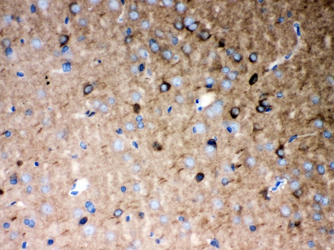 P2RX5 / P2X5 Antibody - P2X5 antibody IHC-paraffin: Rat Brain Tissue.