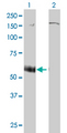 P2RX5 / P2X5 Antibody - Western Blot analysis of P2RX5 expression in transfected 293T cell line by P2RX5 monoclonal antibody (M01), clone 1C5.Lane 1: P2RX5 transfected lysate(46.42 KDa).Lane 2: Non-transfected lysate.