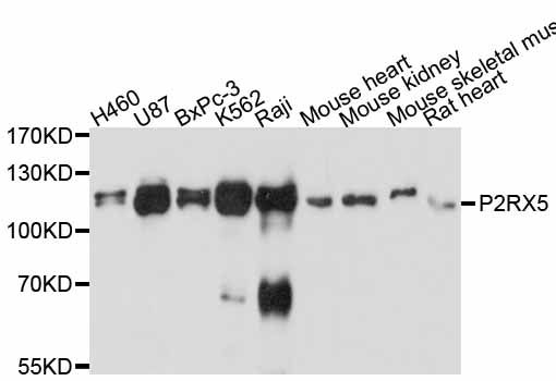 P2RX5 / P2X5 Antibody - Western blot analysis of extracts of various cell lines, using P2RX5 antibody at 1:3000 dilution. The secondary antibody used was an HRP Goat Anti-Rabbit IgG (H+L) at 1:10000 dilution. Lysates were loaded 25ug per lane and 3% nonfat dry milk in TBST was used for blocking. An ECL Kit was used for detection and the exposure time was 10s.