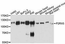 P2RX5 / P2X5 Antibody - Western blot analysis of extracts of various cell lines, using P2RX5 antibody at 1:3000 dilution. The secondary antibody used was an HRP Goat Anti-Rabbit IgG (H+L) at 1:10000 dilution. Lysates were loaded 25ug per lane and 3% nonfat dry milk in TBST was used for blocking. An ECL Kit was used for detection and the exposure time was 10s.