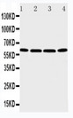 P2RX6 / P2X6 Antibody - WB of P2RX6 / P2X6 antibody. Lane 1: U87 Cell Lysate. Lane 2: 22RV1 Cell Lysate. Lane 3: JURKAT Cell Lysate. Lane 4: HT1080 Cell Lysate.