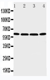 P2RX6 / P2X6 Antibody - WB of P2RX6 / P2X6 antibody. Lane 1: U87 Cell Lysate. Lane 2: 22RV1 Cell Lysate. Lane 3: JURKAT Cell Lysate. Lane 4: HT1080 Cell Lysate.