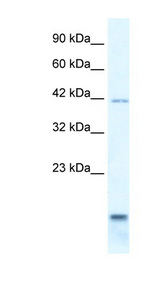 P2RX6 / P2X6 Antibody - P2RX6 / P2X6 antibody Western blot of HepG2 cell lysate. This image was taken for the unconjugated form of this product. Other forms have not been tested.