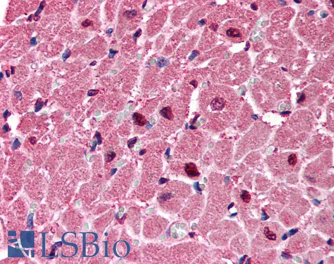P2RX6 / P2X6 Antibody - Anti-P2RX6 / P2X6 antibody IHC of human heart. Immunohistochemistry of formalin-fixed, paraffin-embedded tissue after heat-induced antigen retrieval. Antibody concentration 1.25 ug/ml. This image was taken for the unconjugated form of this product. Other forms have not been tested.