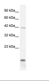 P2RX6 / P2X6 Antibody - HepG2 Cell Lysate.  This image was taken for the unconjugated form of this product. Other forms have not been tested.