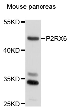 P2RX6 / P2X6 Antibody - Western blot analysis of extracts of mouse pancreas, using P2RX6 antibody at 1:1000 dilution. The secondary antibody used was an HRP Goat Anti-Rabbit IgG (H+L) at 1:10000 dilution. Lysates were loaded 25ug per lane and 3% nonfat dry milk in TBST was used for blocking. An ECL Kit was used for detection and the exposure time was 90s.