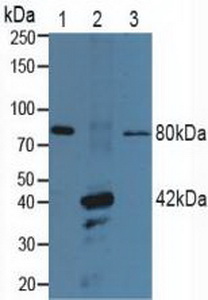 P2RX7 / P2X7 Antibody - Western Blot; Lane1: Porcine Brain Tissue; Lane2: Porcine Stomach Tissue; Lane3: Porcine Heart Tissue.