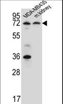 P2RX7 / P2X7 Antibody - P2RX7 Antibody western blot of MDA-MB435 cell line and mouse kidney tissue lysates (15 ug/lane). The P2RX7 antibody detected the P2RX7 protein (arrow).