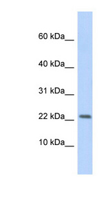 P2RX7 / P2X7 Antibody - P2RX7 / P2X7 antibody Western blot of Fetal Heart lysate. This image was taken for the unconjugated form of this product. Other forms have not been tested.