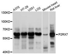 P2RX7 / P2X7 Antibody - Western blot analysis of extracts of various cell lines, using P2RX7 antibody at 1:1000 dilution. The secondary antibody used was an HRP Goat Anti-Rabbit IgG (H+L) at 1:10000 dilution. Lysates were loaded 25ug per lane and 3% nonfat dry milk in TBST was used for blocking. An ECL Kit was used for detection and the exposure time was 10s.