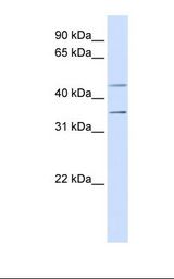P2RY1 / P2Y1 Antibody - Fetal muscle lysate. Antibody concentration: 1.0 ug/ml. Gel concentration: 12%.  This image was taken for the unconjugated form of this product. Other forms have not been tested.