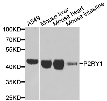 P2RY1 / P2Y1 Antibody - Western blot analysis of extracts of various cells.