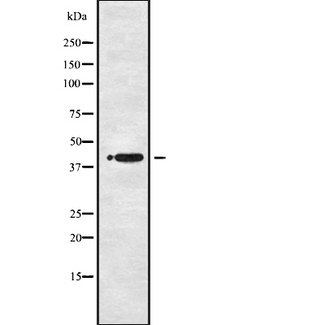 P2RY1 / P2Y1 Antibody - Western blot analysis of P2RY1 using COLO205 whole cells lysates