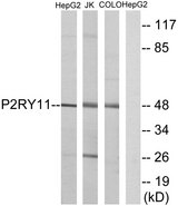 P2RY11 / P2Y11 Antibody - Western blot analysis of lysates from HepG2, Jurkat, and COLO cells, using P2RY11 Antibody. The lane on the right is blocked with the synthesized peptide.