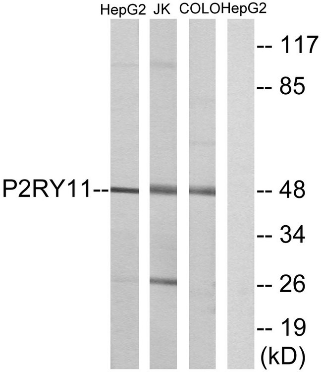 P2RY11 / P2Y11 Antibody - Western blot analysis of lysates from HepG2, Jurkat, and COLO cells, using P2RY11 Antibody. The lane on the right is blocked with the synthesized peptide.