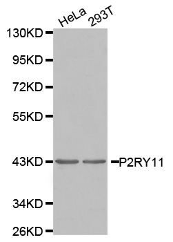 P2RY11 / P2Y11 Antibody - Western blot analysis of extracts of various cell lines.