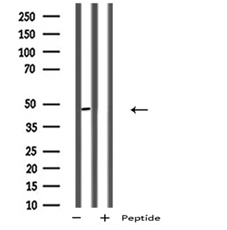 P2RY11 / P2Y11 Antibody - Western blot analysis of extracts of HepG2 cells using P2RY11 antibody.