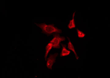 P2RY11 / P2Y11 Antibody - Staining HepG2 cells by IF/ICC. The samples were fixed with PFA and permeabilized in 0.1% Triton X-100, then blocked in 10% serum for 45 min at 25°C. The primary antibody was diluted at 1:200 and incubated with the sample for 1 hour at 37°C. An Alexa Fluor 594 conjugated goat anti-rabbit IgG (H+L) Ab, diluted at 1/600, was used as the secondary antibody.