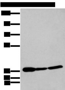 P2RY11 / P2Y11 Antibody - Western blot analysis of 293T and Hela cell lysates  using P2RY11 Polyclonal Antibody at dilution of 1:250
