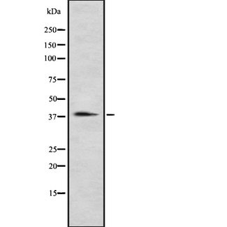 P2RY12 / P2Y12 Antibody - Western blot analysis of P2RY12 using Jurkat whole cells lysates